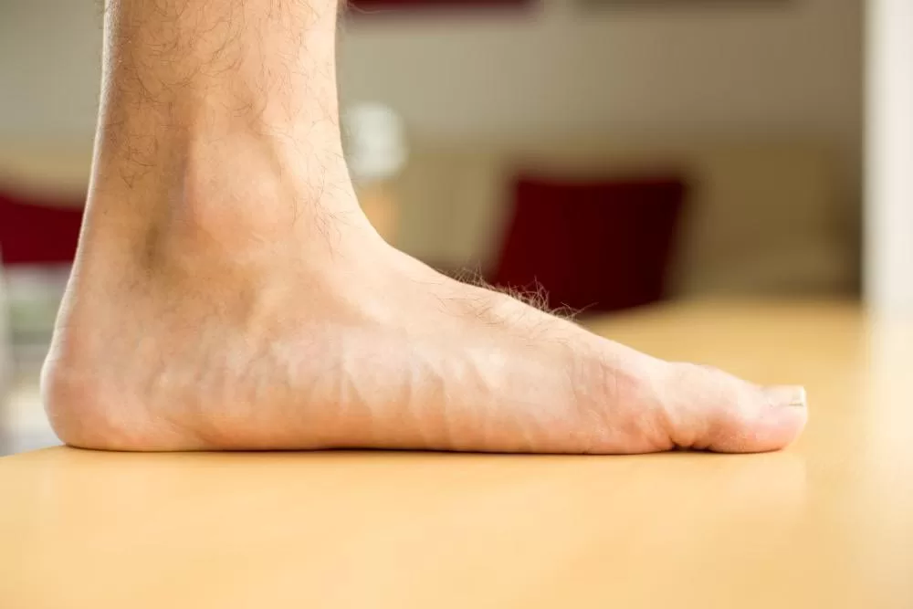 ما الذي يسبب الأقدام المسطحة ؟