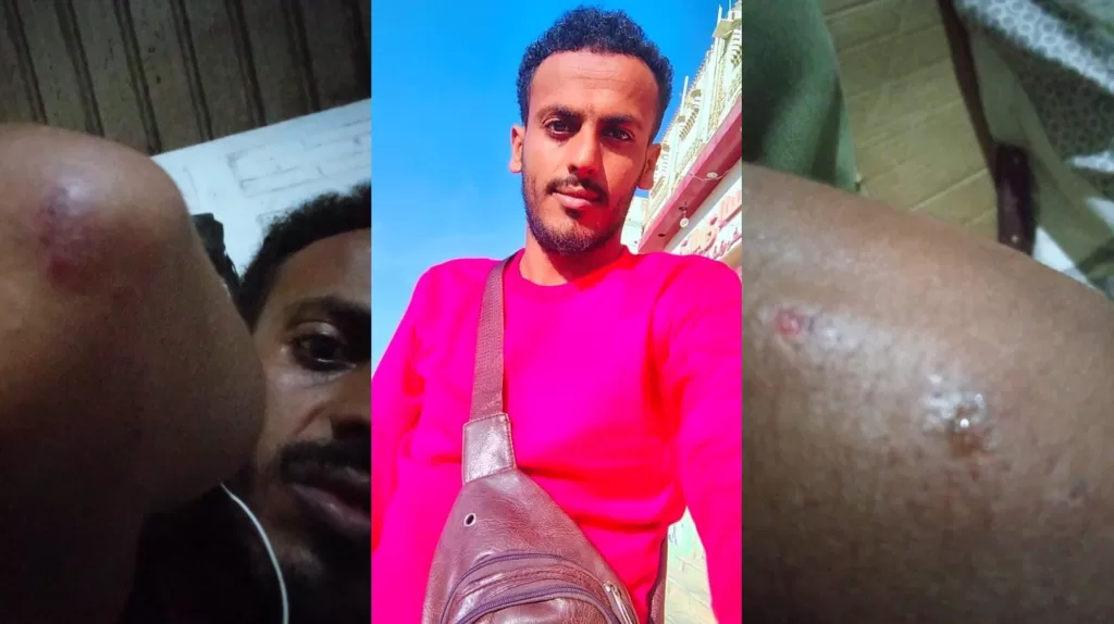 تعرض الناشط الساخر شيز الضالعي، الملقب بـ "أبو عيون"، لهجوم غادر بسلاح أبيض في جنوب اليمن، ما أسفر عن إصابته بجروح وسرقة جميع جوالاته.