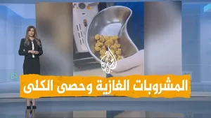 شاهد شبكات | استخراج 30 حصوة من كلية مريض بسبب المشروبات الغازية